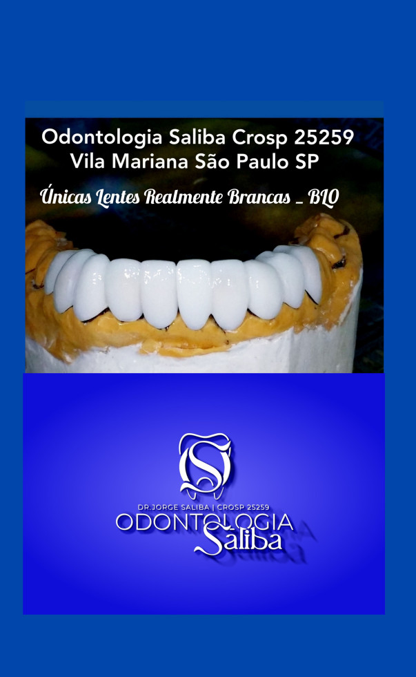 Sorriso Realmente Branco 👑 
Não escurecem com o tempo👏