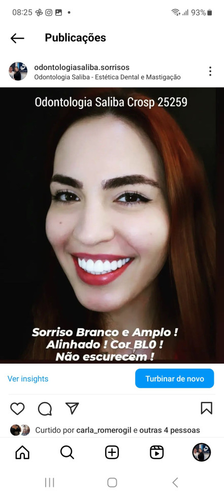 Único Sorriso Branco Real